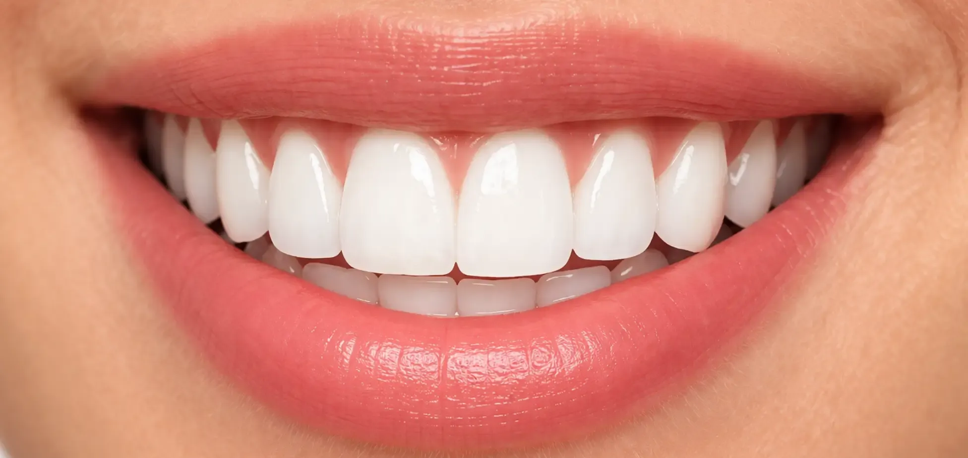 1952x923 px Diş Beyazlatma.webp
