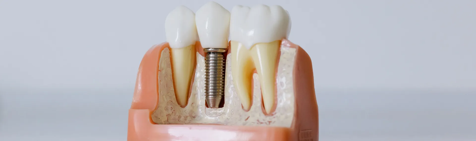 1920x570 px Web slider boyutu .png