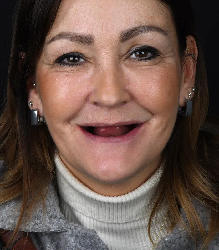 Hasta 39