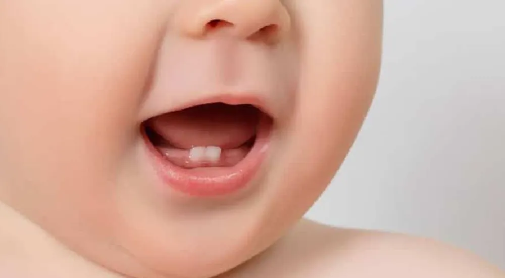 Çocuğumun dişleri sallanıyor, alttan daimi dişi geliyor?