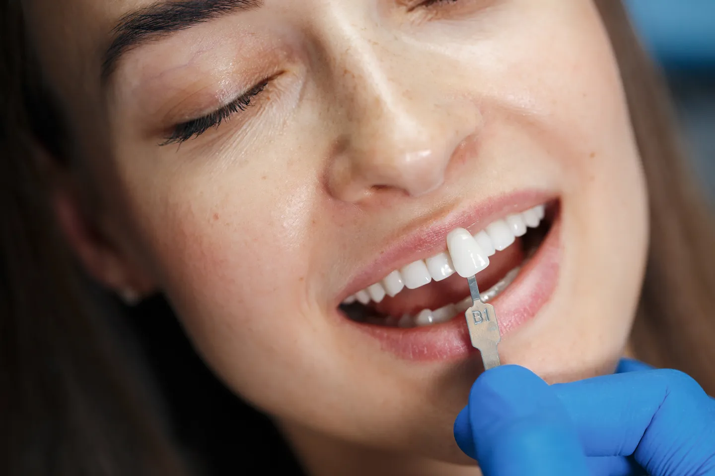 dentist-white-teeth (1).jpg