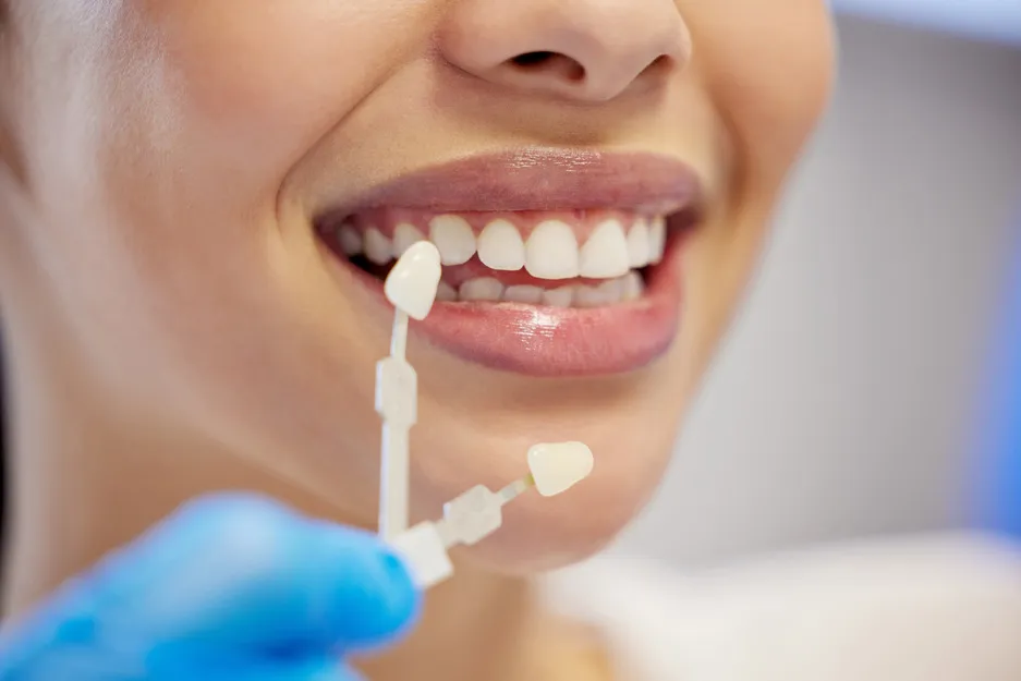 dentist-cleaning-dental-procedure-toothache-clinic-health-treatment-mouth-teeth-whitening-face-person-with-torque-wrench-machine-orthodontics-oral-care-veneers (1).jpg