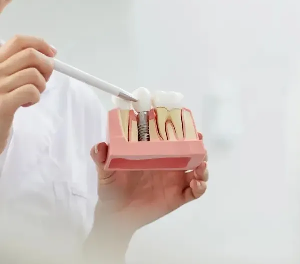 implant-dis kopyası.png